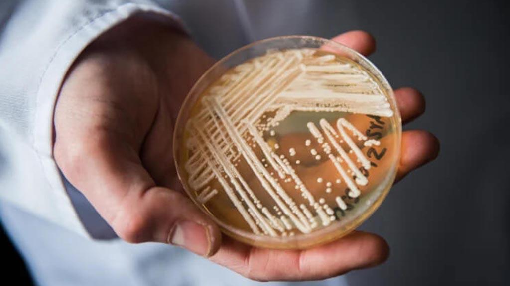 deadly-candida-auris-fungus-spreads-in-us-healthcare